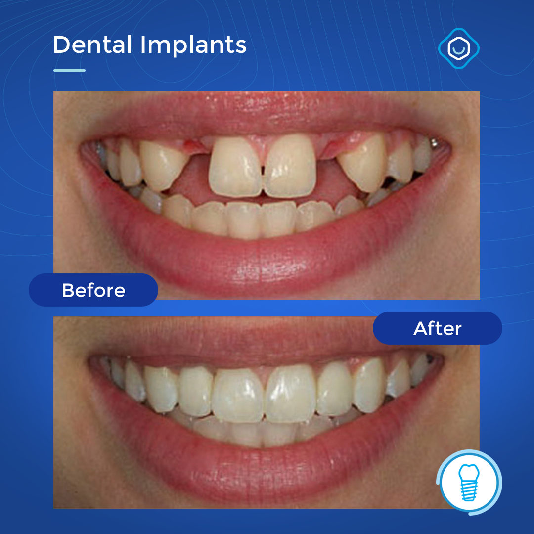 Perion Dental Health Center